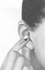 颈椎病按摩部位图解