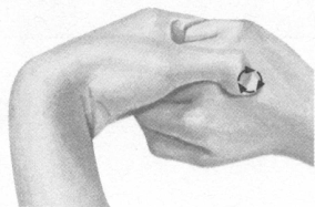 腰椎间盘突出症按摩部位图解