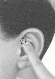 糖尿病按摩部位图解