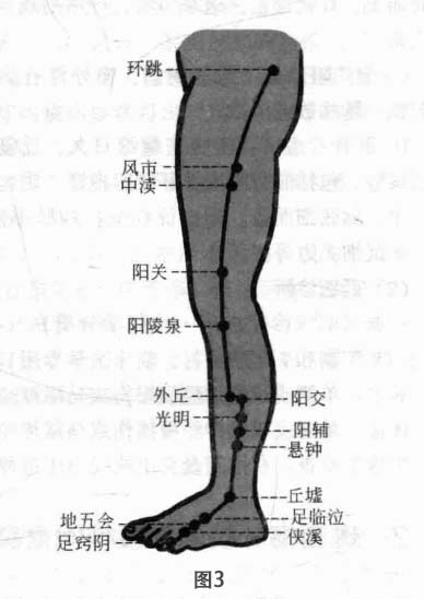 腰椎间盘突出症磁圆梅针疗法