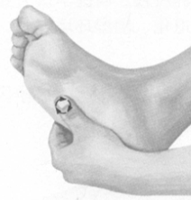 风湿病按摩部位图解