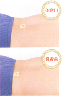 慢性前列腺炎艾灸哪个部位图解