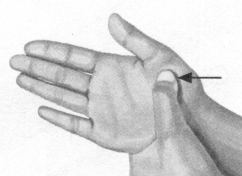 高脂血症按摩部位图解