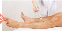 不育症艾灸哪个部位图解