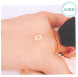 肺心病艾灸哪个部位图解