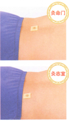 益肾温阳艾灸调理方艾灸哪个部位图解