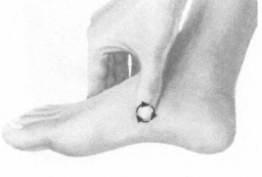 糖尿病按摩部位图解