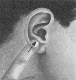 耳鸣-耳痛按摩部位图解