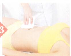 湿热体质拔罐部位图解