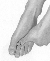 更年期综合征按摩部位图解