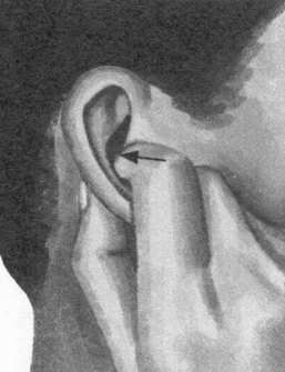 耳鸣-耳痛按摩部位图解