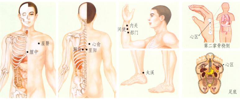 冠心病刮痧部位图解