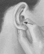 肩周炎按摩部位图解