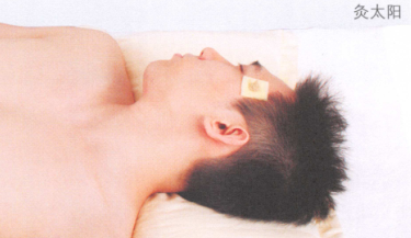 头痛艾灸哪个部位图解