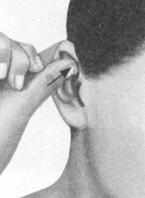 肥胖症按摩部位图解