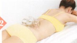 腰椎间盘突出拔罐部位图解