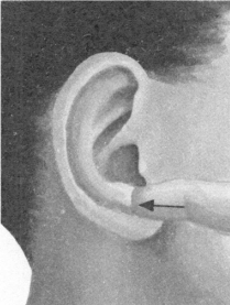 腰椎间盘突出症按摩部位图解