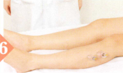 胆结石拔罐部位图解