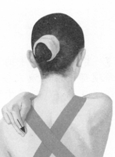 冠心病按摩部位图解