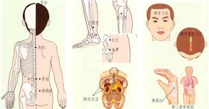 小儿遗尿刮痧部位图解