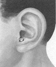 痛经按摩部位图解