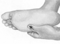 腹泻按摩部位图解