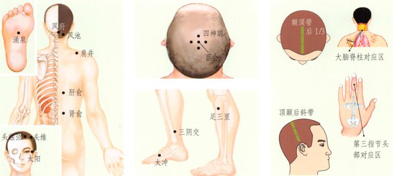 眩晕刮痧部位图解