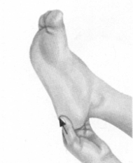 经前期综合征按摩部位图解