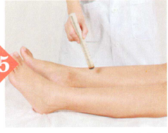 痔疮艾灸哪个部位图解