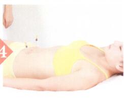 湿热体质拔罐部位图解