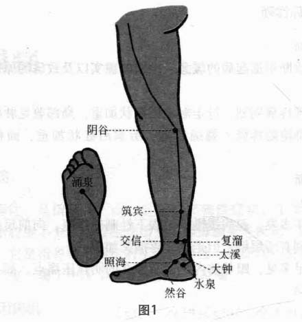 足跟痛磁圆梅针疗法