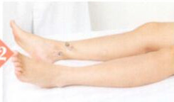 胎位不正拔罐部位图解