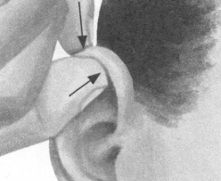 高脂血症按摩部位图解