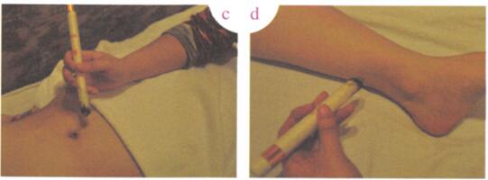 盆腔炎艾灸哪个部位图解