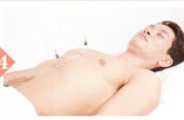 冠心病拔罐部位图解