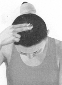 高脂血症按摩部位图解