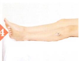 血瘀体质拔罐部位图解