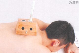 预防感冒艾灸哪个部位图解