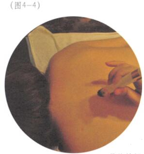 暑湿感冒艾灸哪个部位图解