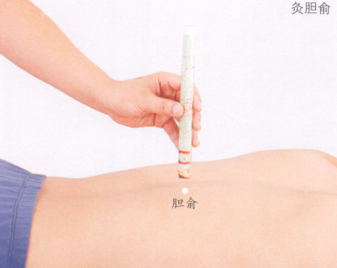 胆石症艾灸哪个部位图解