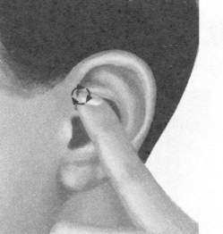 更年期综合征按摩部位图解