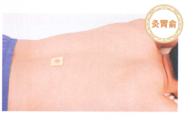 食欲不振艾灸哪个部位图解