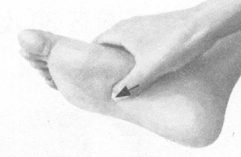 失眠症按摩部位图解