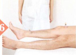 阴囊潮湿拔罐部位图解