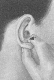 肥胖症按摩部位图解