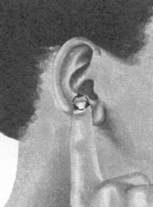 鼻炎按摩部位图解