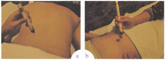 痛经艾灸哪个部位图解