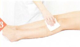 子宫脱垂拔罐部位图解