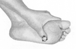 高脂血症按摩部位图解