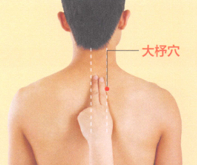 落枕艾灸哪个部位图解